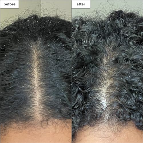 Briogeo Scalp Revival Charcoal + Coconut Oil Micro-Exfoliating Shampoo, Treatment for Dry & Itchy Scalp, Clarifying Shampoo for Build Up, Scalp Scrub for Oily Scalp, Vegan, Cruelty-Free, 32 fl oz