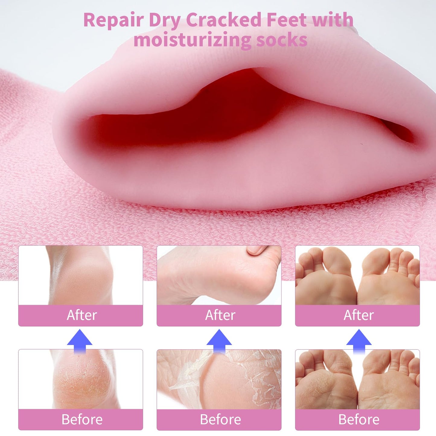Aluroice 10" Large Silicone Moisturizing Socks for Women - 2Pairs Soft Gel Foot Moisturizing Socks for Dry Cracked Feet