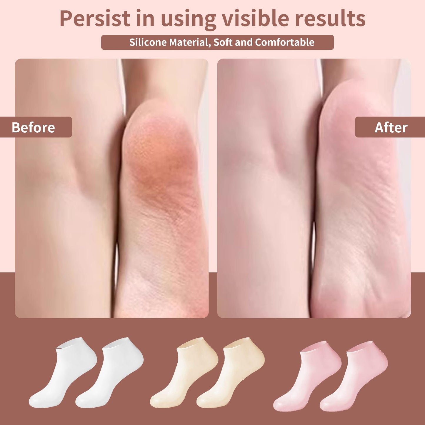 Aloe Vera Silicone Socks for Women - 6 Pairs, Moisturizing Spa Pedicure Socks for Repairing Dry Feet, Cracked Heels & Softening Rough Skin - Pink, White & Beige