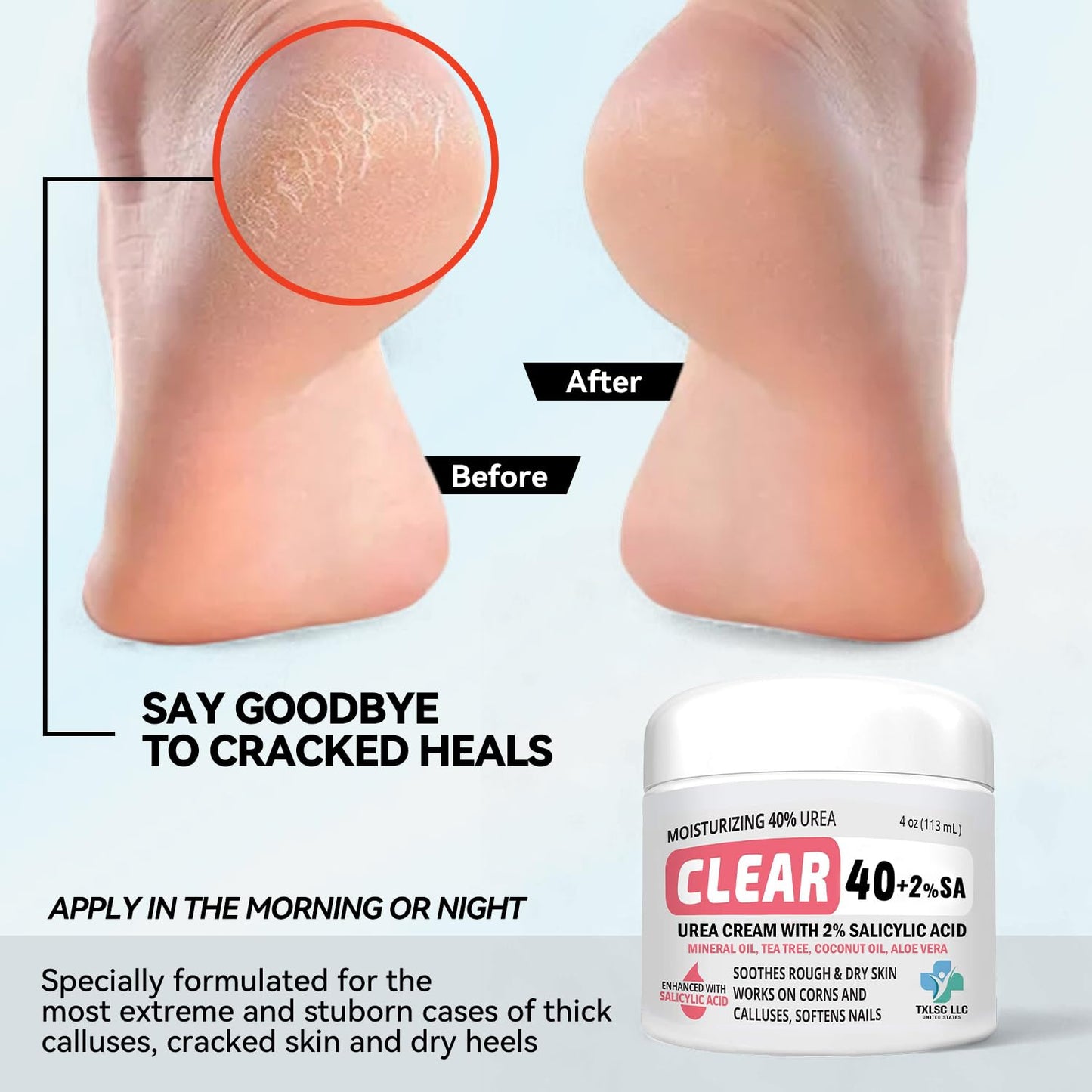 CLEAR Urea Cream 40 Percent Plus 2% Salicylic Acid (4oz) Made in USA | Urea Foot & Hand Cream Softens Cracked Heels & Dry Skin with Tea Tree & Coconut Oil - Callus & Corn Treatment