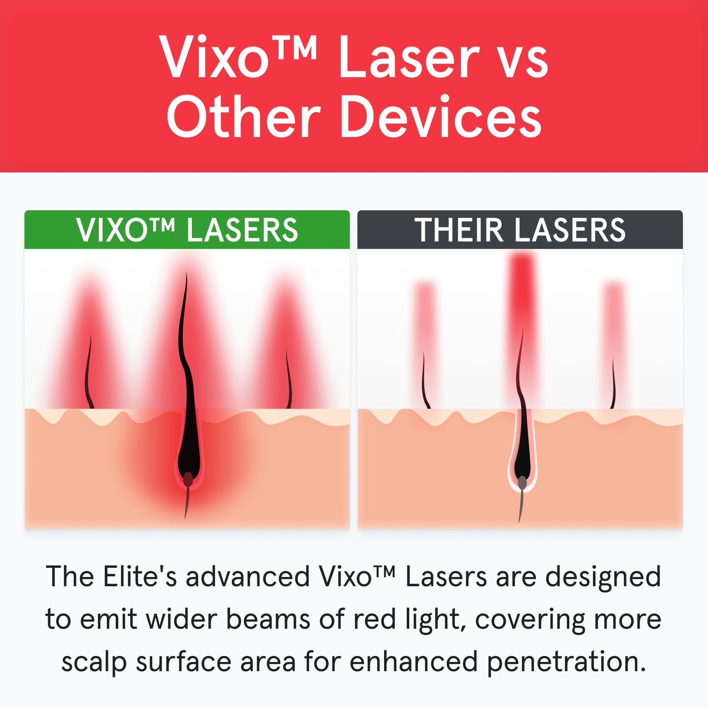 iRestore Elite - Laser Red Light Therapy for Hair Growth System - FDA Cleared Hair Loss, Hair Thinning & Alopecia Treatment for Men & Women - Laser Cap for Hair Regrowth Stimulates Denser Fuller Hair