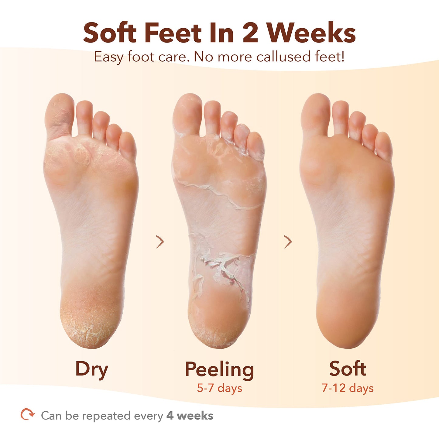 Purederm Exfoliating Foot Mask (3 Pack) – Regular Size Exfoliating Foot Masks for Cracked Feet, Dry Skin, Callused Feet…
