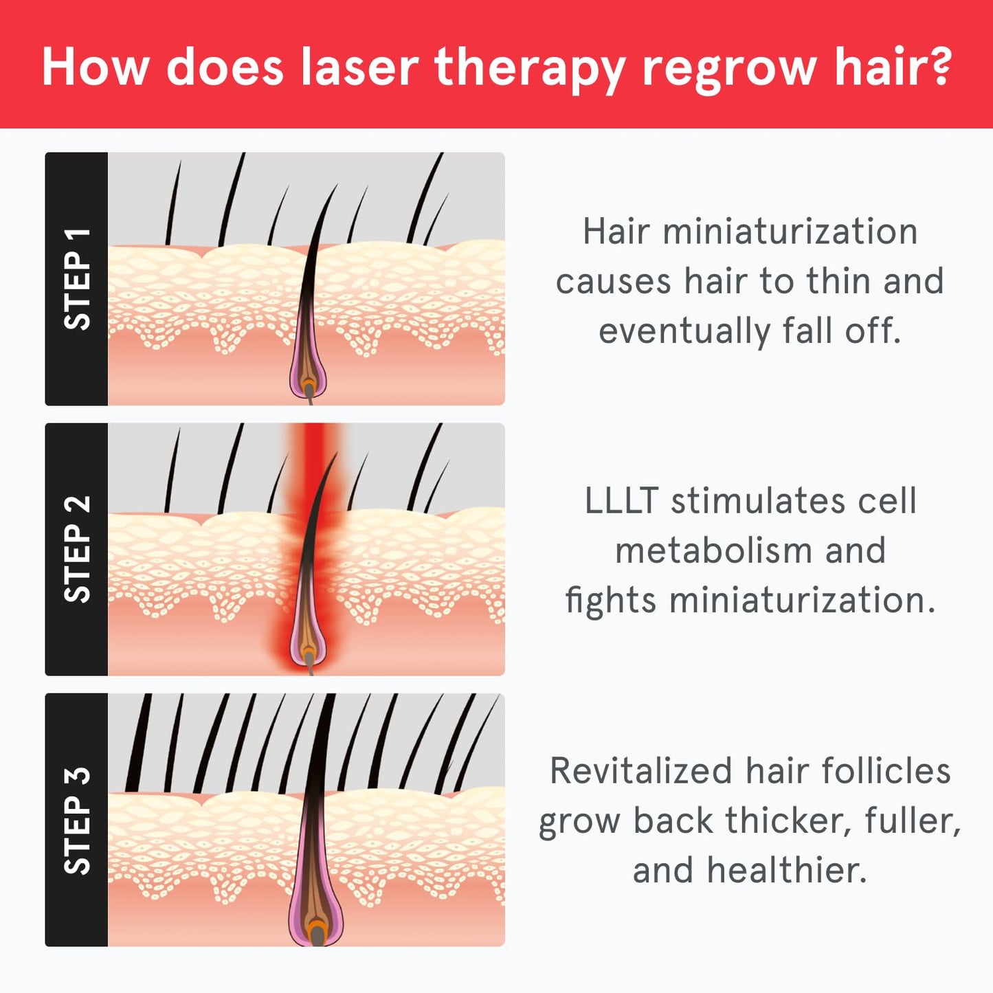iRestore Essential - Laser Red Light Therapy for Hair Growth - FDA Cleared Hair Loss, Hair Thinning & Alopecia Treatment for Men & Women - Laser Cap for Hair Regrowth Stimulate Denser Fuller Hair
