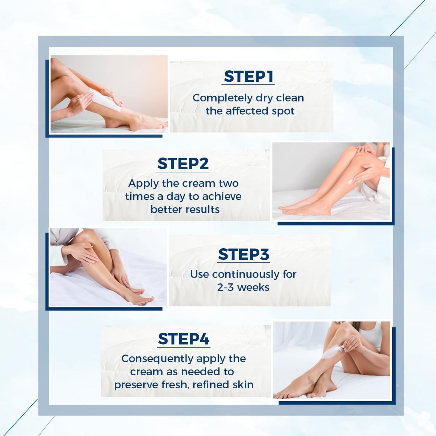 OUKEYA Urea Cream 40 Percent, Foot & Hand Cream for Dry Cracked, Urea Lotion for Feet Maximum Strength(12.35Oz X 4 Packs)