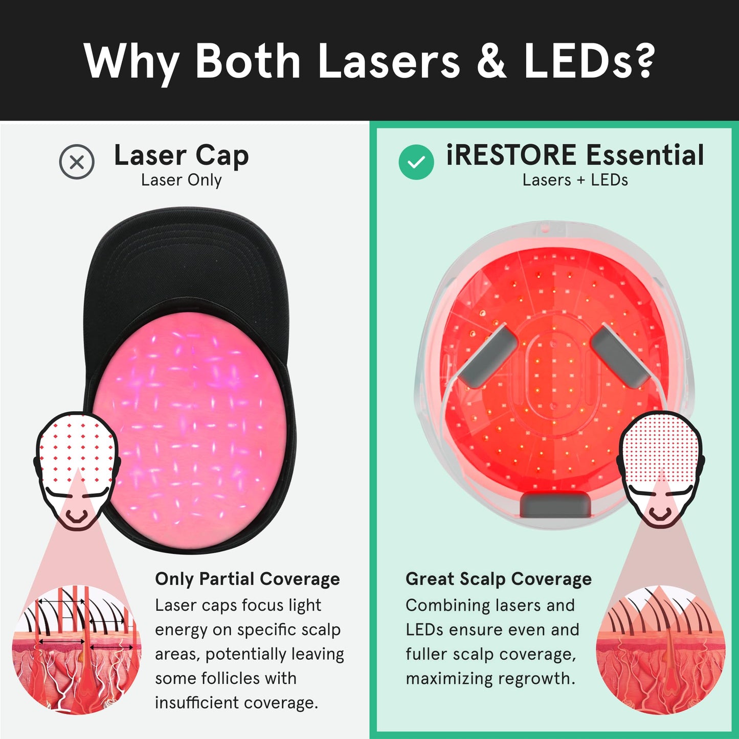 iRestore Essential - Laser Red Light Therapy for Hair Growth - FDA Cleared Hair Loss, Hair Thinning & Alopecia Treatment for Men & Women - Laser Cap for Hair Regrowth Stimulate Denser Fuller Hair