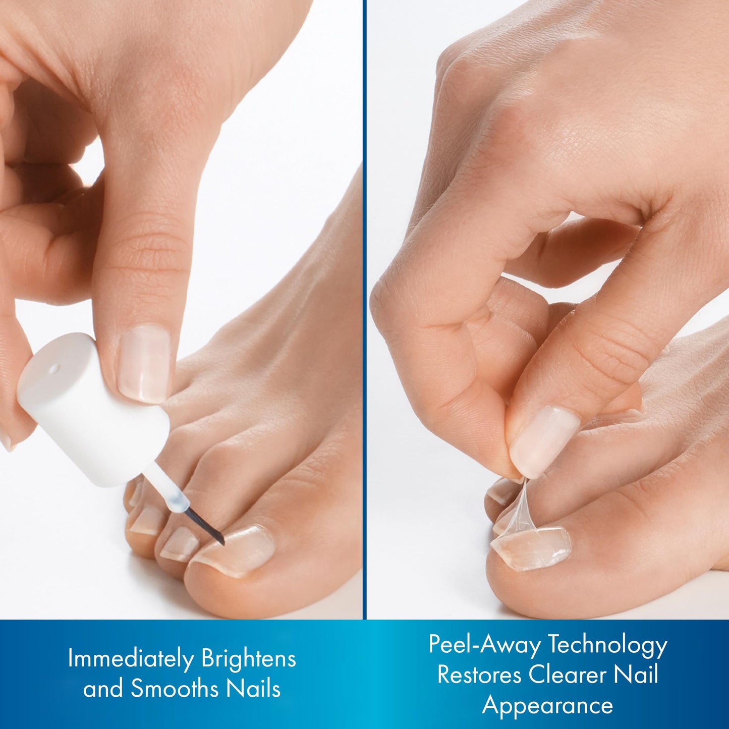 ProClearz Brite Now Nail Treatment, Restores The Appearance Of Damaged & Discolored Nails, Peel-Away Technology, Brightening & Smoothing Nail Repair, 0.5 Ounce