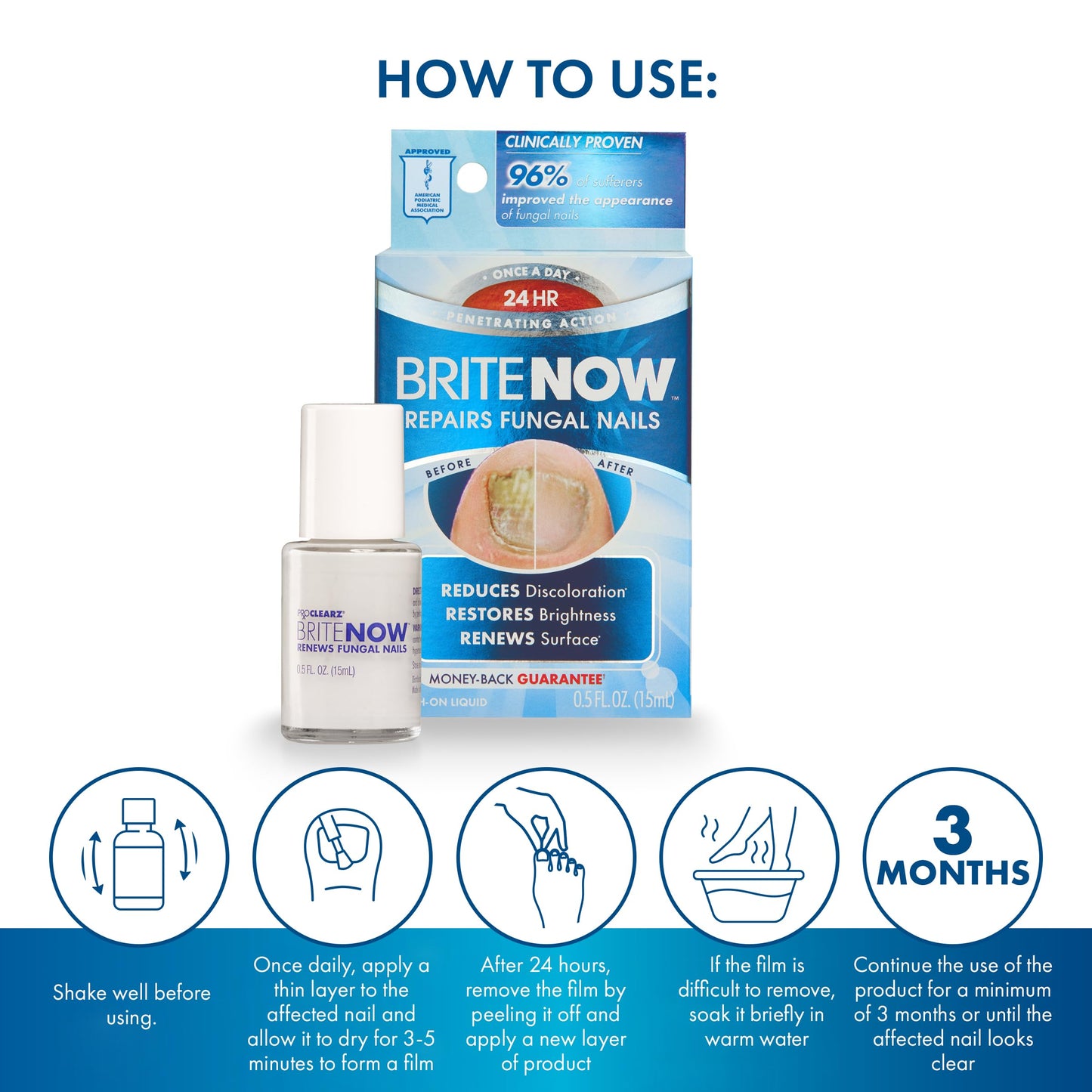 ProClearz Brite Now Nail Treatment, Restores The Appearance Of Damaged & Discolored Nails, Peel-Away Technology, Brightening & Smoothing Nail Repair, 0.5 Ounce