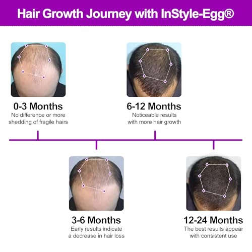 InStyle-Egg 272 Pro Max Laser Cap for Hair Regrowth | FDA Cleared Laser Hair Growth Device | Red Light Therapy, Hair Loss Treatment for Men and Women.
