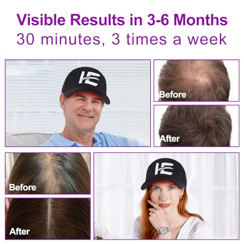 InStyle-Egg 272 Pro Max Laser Cap for Hair Regrowth | FDA Cleared Laser Hair Growth Device | Red Light Therapy, Hair Loss Treatment for Men and Women.