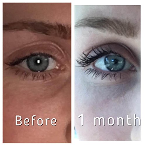 Pronexa Hairgenics Lavish Lash (3ml, 3 Month Supply) – Eyelash Growth Enhancer & Brow Serum with Natural Peptides for Long, Thick Lashes and Eyebrows! Dermatologist Certified & Hypoallergenic.