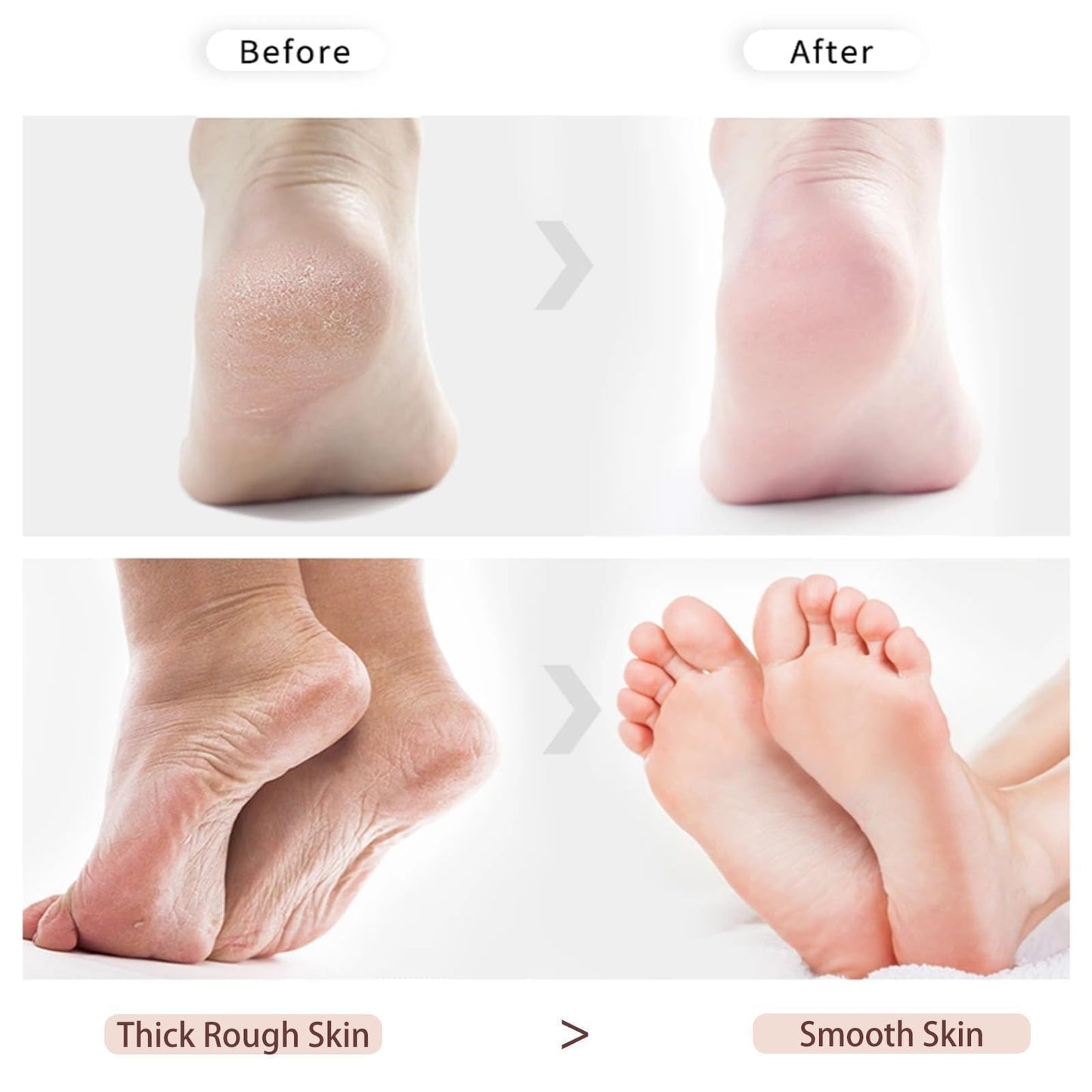 1 Pack Double-Sided Pumice Stone for Feet, Pumice Stone for Feet, Foot Scrubber，Effective Pedicure Tools (Purple)