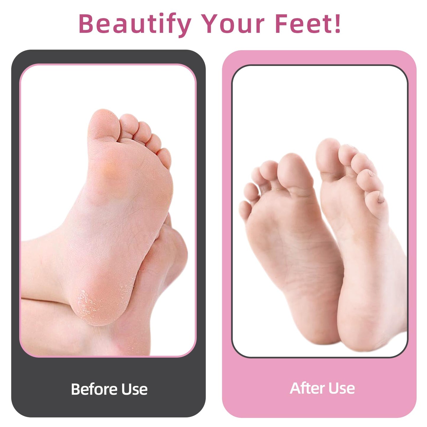 AprElm 4.8IN Longer Electric Foot Callus Remover, Professional Aluminum Callus Remover for Feet with 80pcs Sandpaper Discs, Stepless Speed Control Pedicure Tools for Dead Skin Calluses (Dark Black)