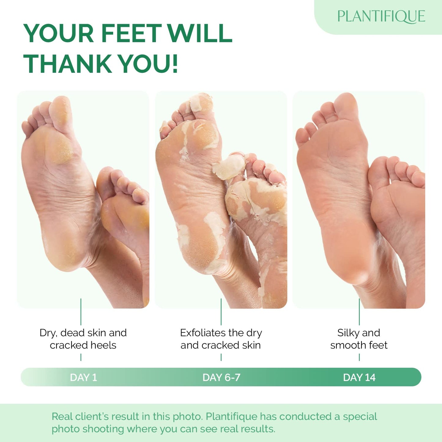 PLANTIFIQUE Foot Peeling Mask - Dermatologically Tested to Repair Heels & Remove Dead Skin for Baby Soft Feet - Exfoliating Peel Mask for Cracked Feet (Peach, 2 pack)