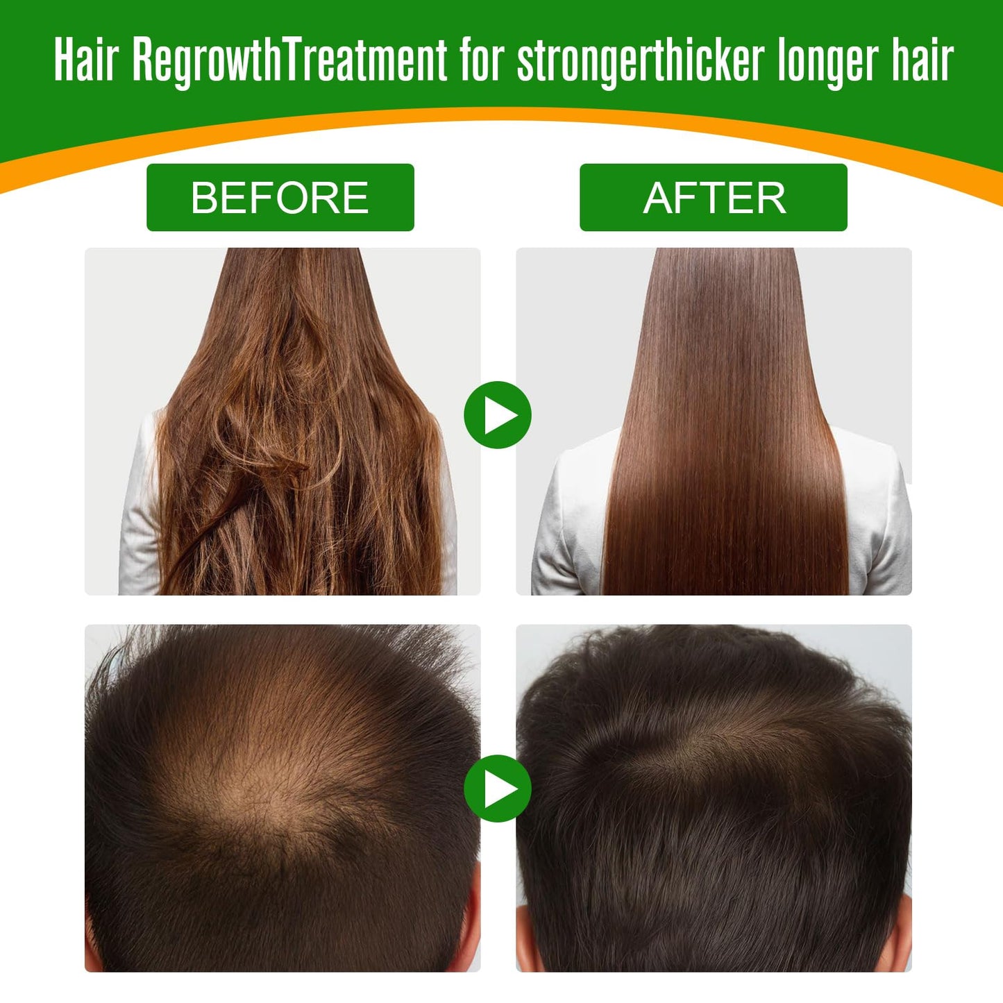 ALIVER Hair Growth Oil - 100% Natural Cold-Pressed Batana Oil, Enhances Radiance, Combats Hair Loss & Repairs Damage - 2.02 Fl Oz