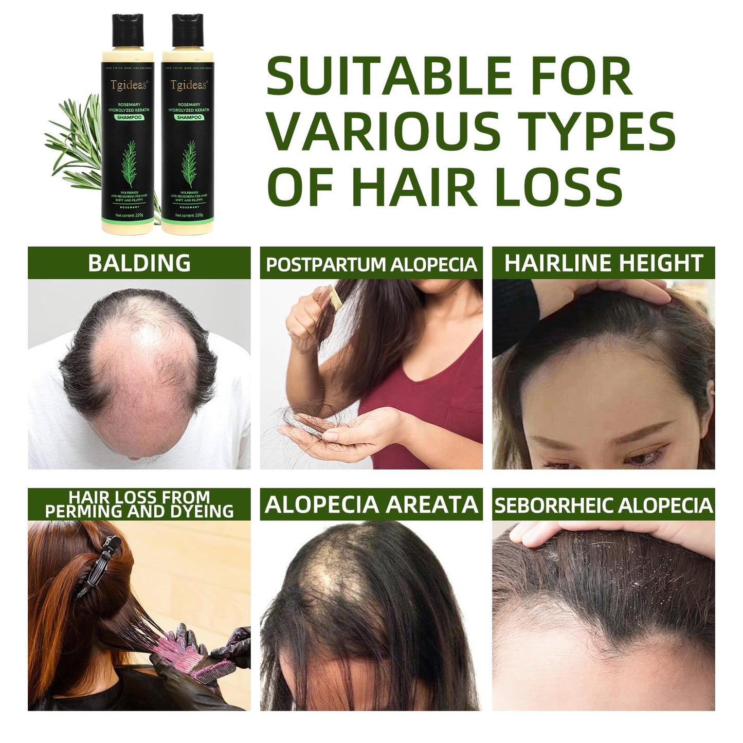 Organic Rosemary Hair Growth Shampoo for Women and Men-Natural Thickening & Strengthening Shampoo with Hydrolyzed Keratin for Thinning Hair & Hair Loss 7.4 fl.oz - 2 Packs