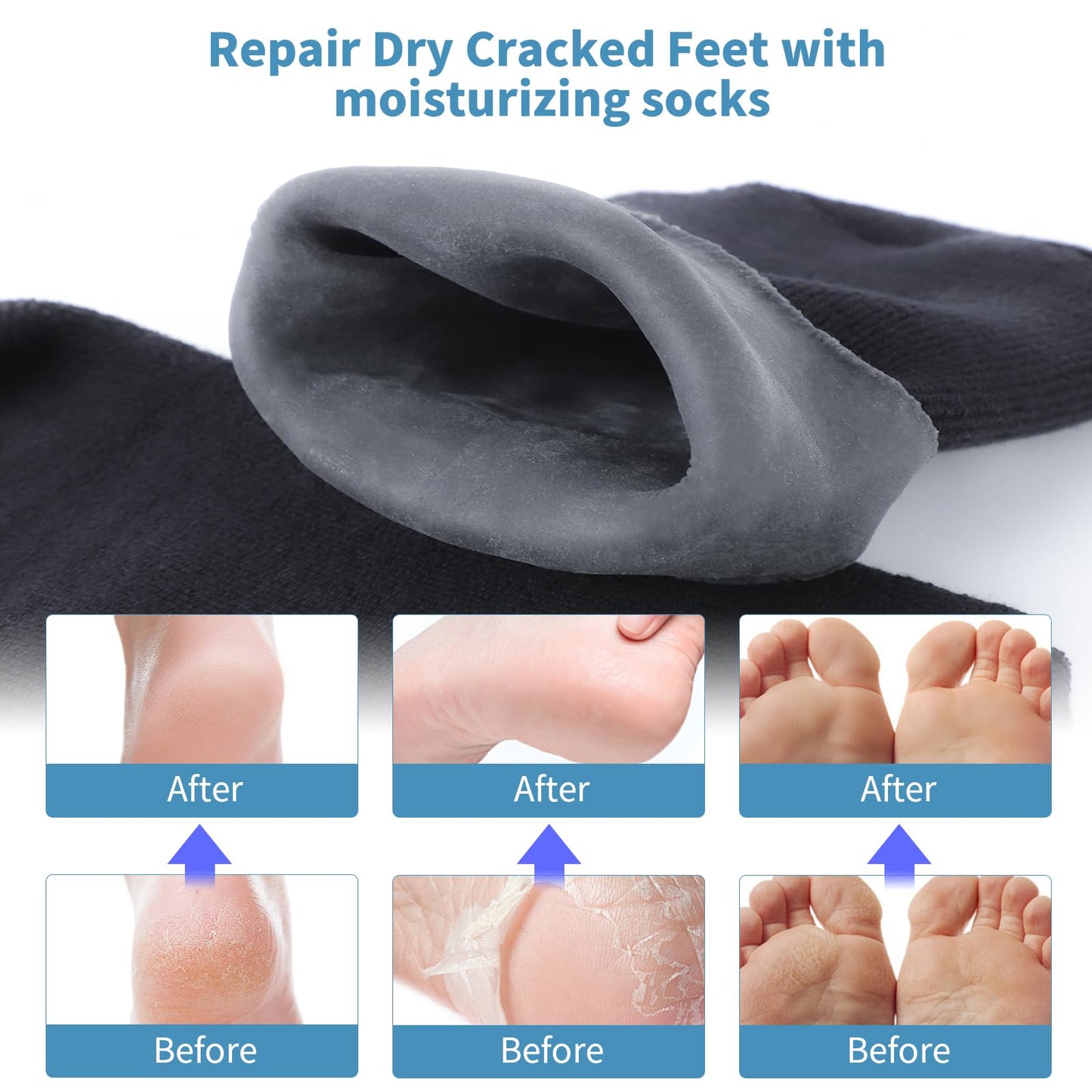 Aluroice Silicone Moisturizing Socks for Men - 2 Pairs Soft Foot Care Socks - Large Size Feet Moisturizing Socks for Dry Cracked Feet (Size M)