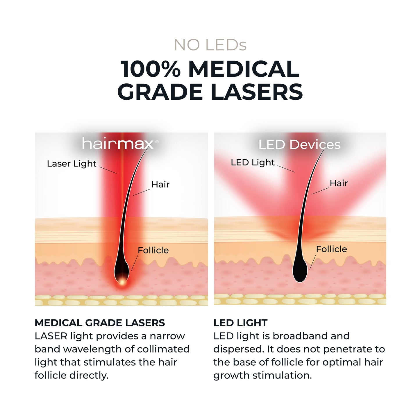 Hairmax RegrowMD - FDA Cleared Laser Hair Growth Cap Device - Thinning Hair Loss Treatment for Men & Women - Scalp Health Improvement - 30 Minute Sessions - Red Light Therapy - Fits Most Heads