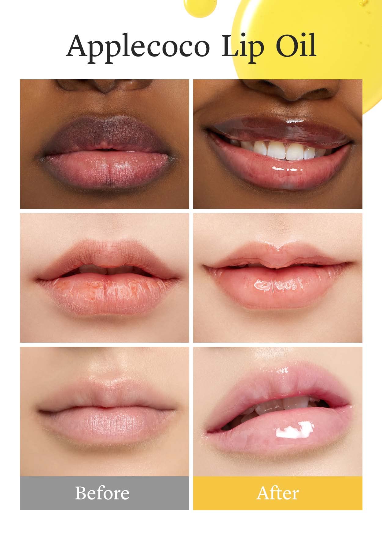 NOONI Korean Lip Butter Melting Balm (Applebutter) + Korean Vegan Lip Oil - Applecoco 0.12 Fl Oz Bundle