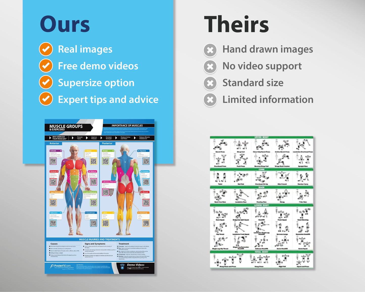 Muscle Groups & Exercises Gym Poster - Laminated - EXTRA LARGE 33” x 23.5” - Gym & Home Fitness Wall Chart - Includes Online Video Training
