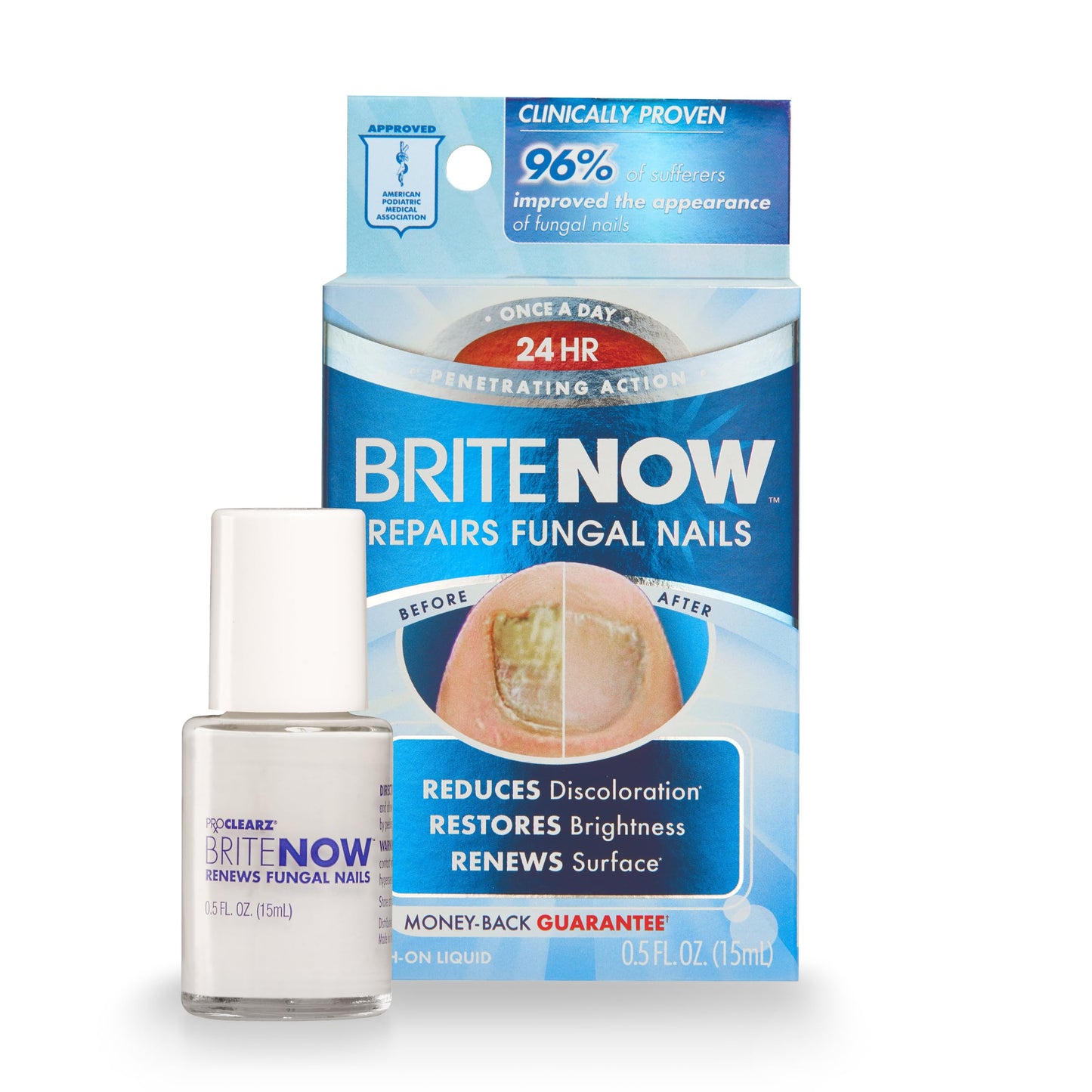 ProClearz Brite Now Nail Treatment, Restores The Appearance Of Damaged & Discolored Nails, Peel-Away Technology, Brightening & Smoothing Nail Repair, 0.5 Ounce