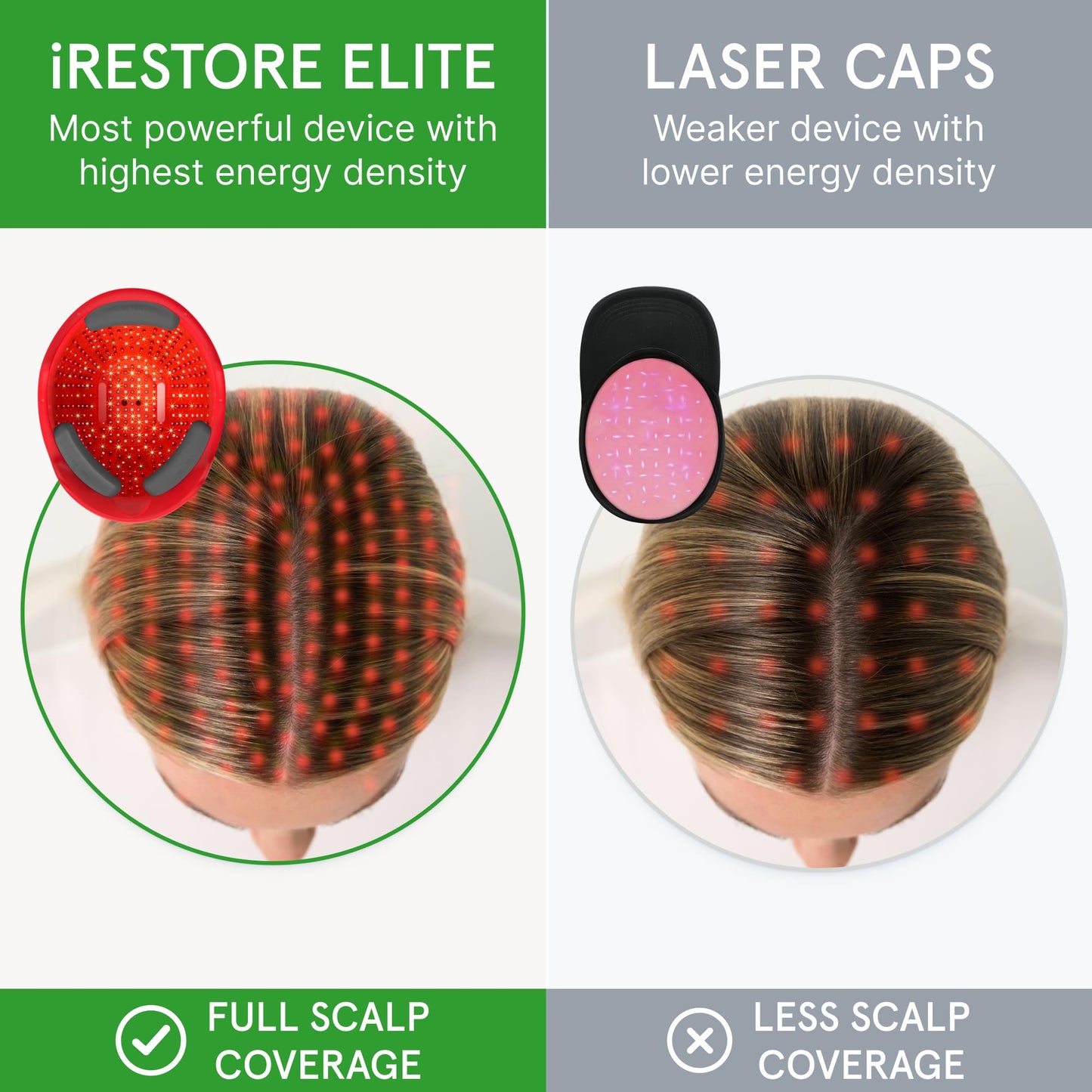 iRestore Elite - Laser Red Light Therapy for Hair Growth System - FDA Cleared Hair Loss, Hair Thinning & Alopecia Treatment for Men & Women - Laser Cap for Hair Regrowth Stimulates Denser Fuller Hair