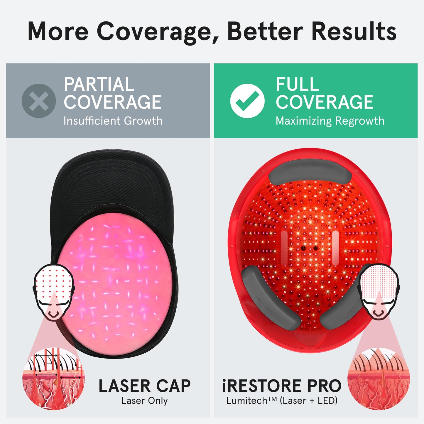 iRestore Professional + Rechargeable Battery Pack - Laser Red Light Therapy for Hair Growth - FDA Cleared Hair Loss, Thinning Treatment for Men & Women - Hair Regrowth Cap - 282 Lasers & LEDs