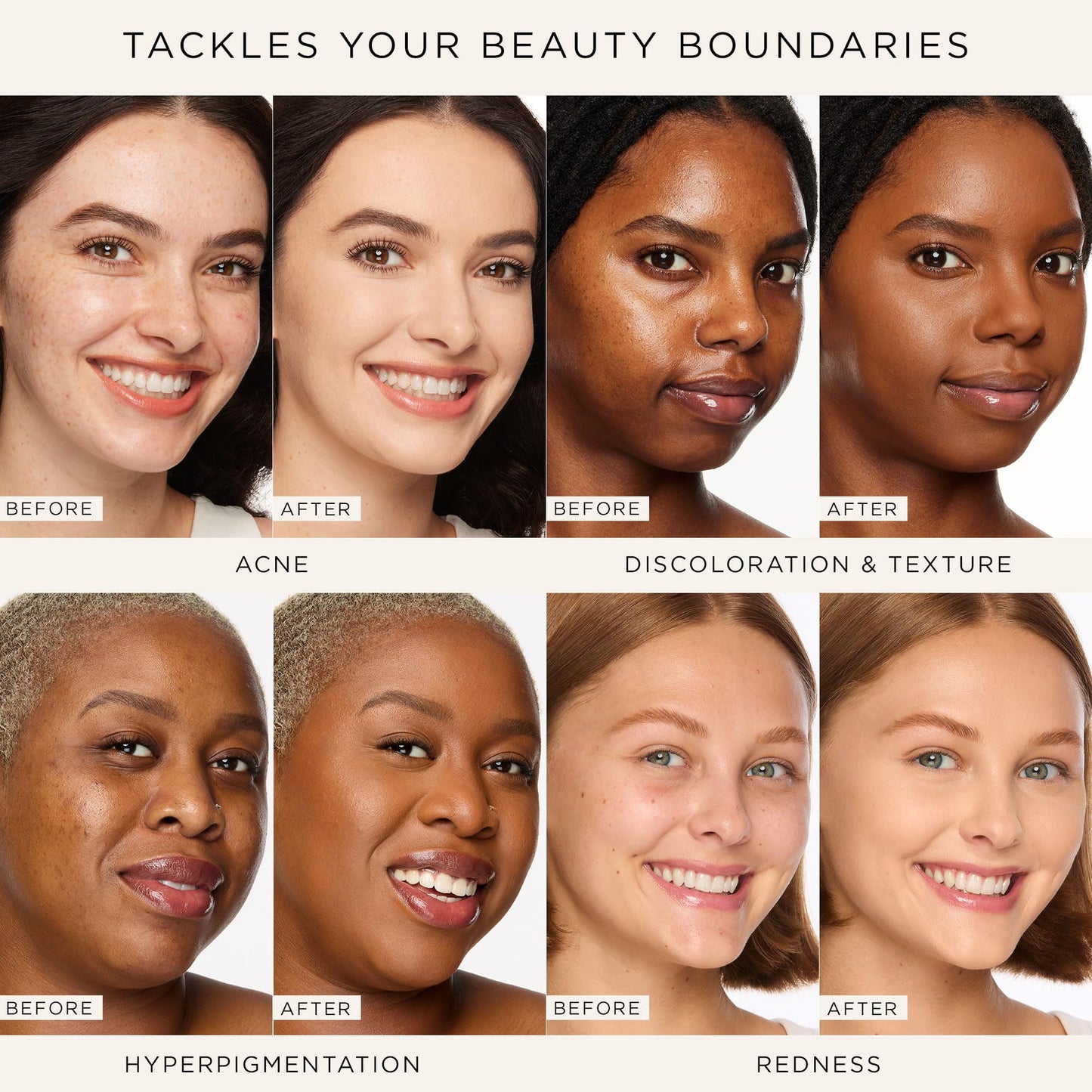 tarte shape tape full-coverage concealer - 29N light-medium (light to medium skin with a balance of warm & cool undertones)