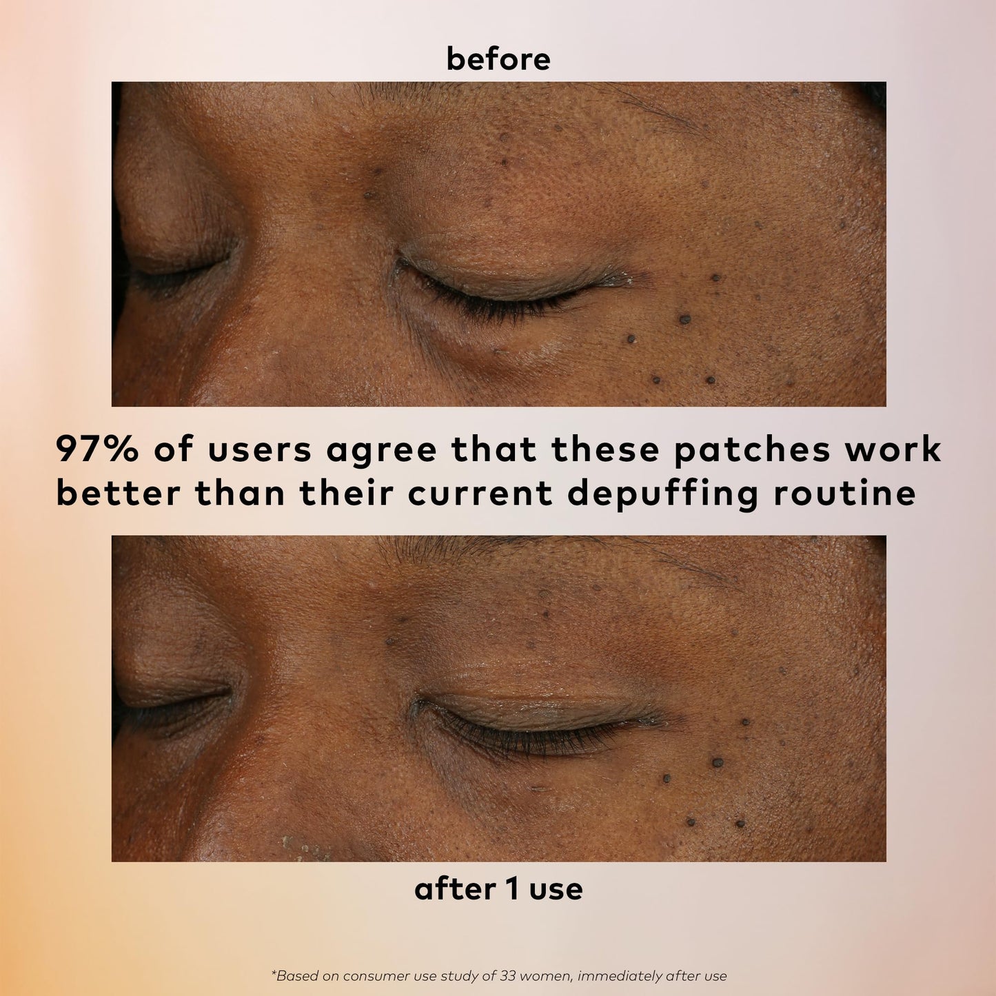 The Good Patch De-Puff Cooling Hydrogel Under Eye Patches for Puffy Eyes and Under Eye Bags, Made with Caffeine, Aloe Vera, Gotu Kola, Clinically Proven (18 Total Patch Sets)