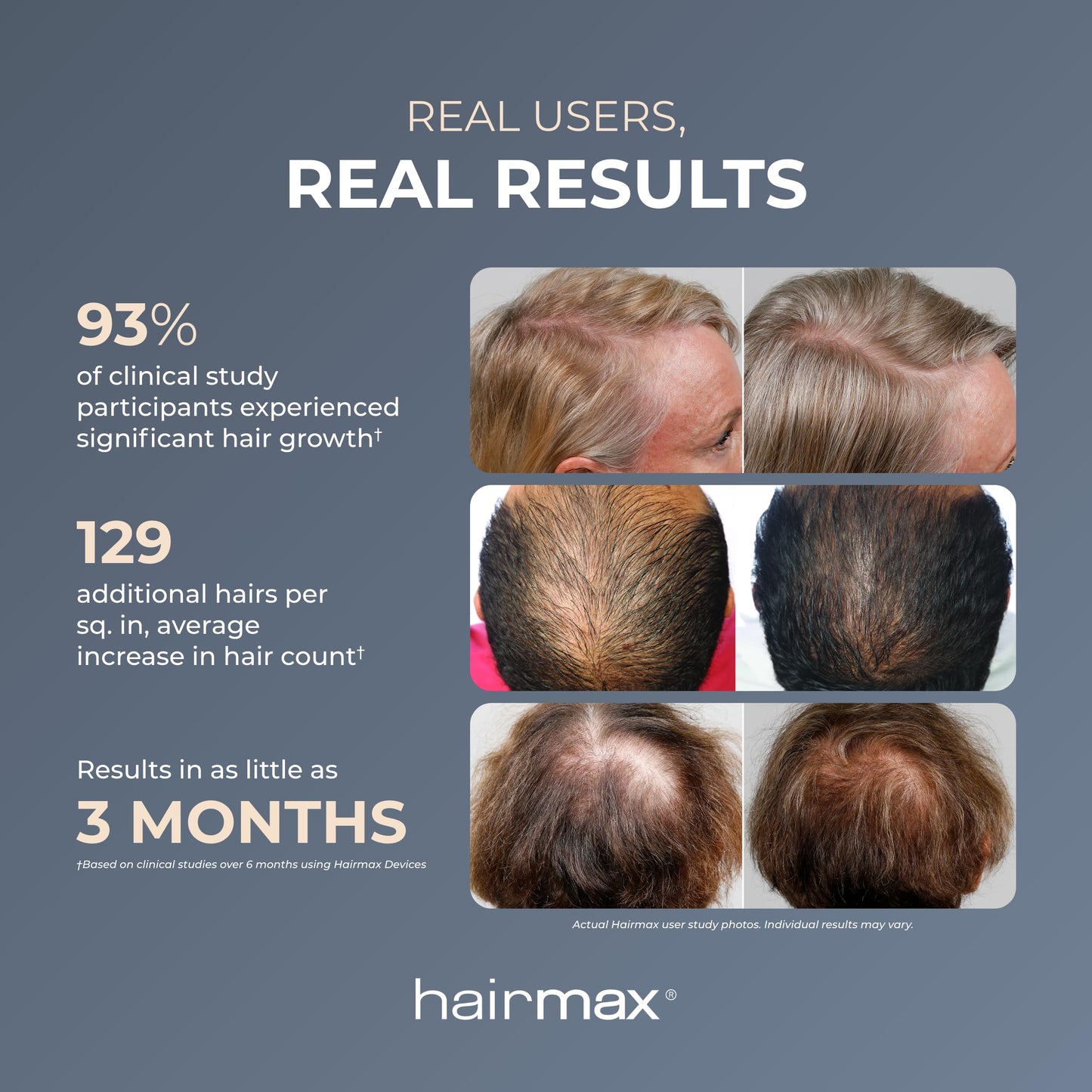 Hairmax RegrowMD - FDA Cleared Laser Hair Growth Cap Device - Thinning Hair Loss Treatment for Men & Women - Scalp Health Improvement - 30 Minute Sessions - Red Light Therapy - Fits Most Heads